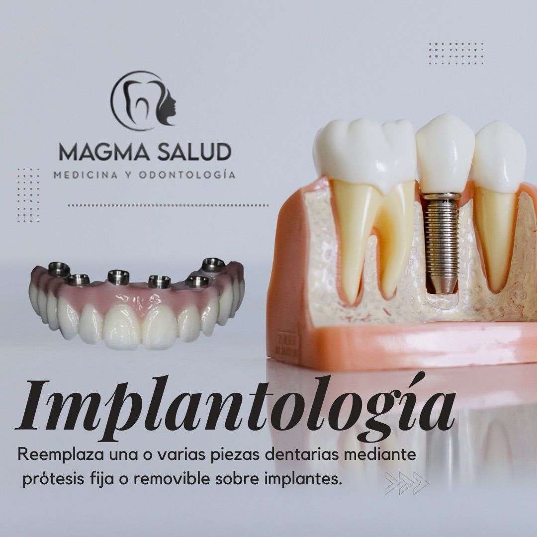 Descripción de la imagen
